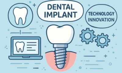 Dental Implant