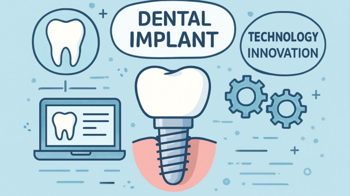 Dental Implant
