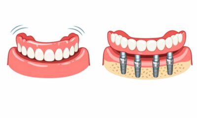 Dentures