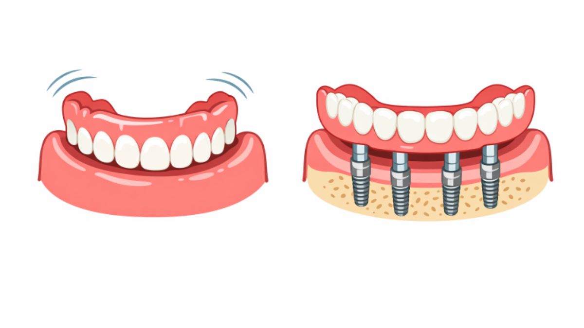 Dentures