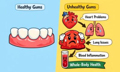 Health