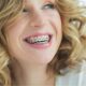 Cosmetic Dentistry